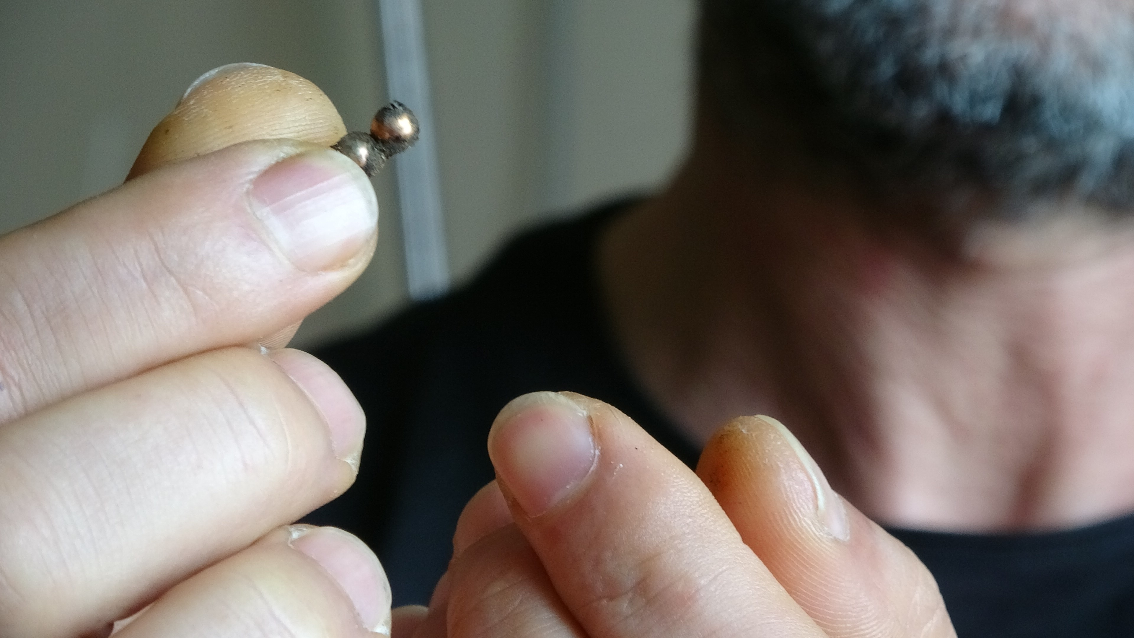 Rize'de küçük çocuk mıknatıslı topları yuttu, bağırsağı delindi