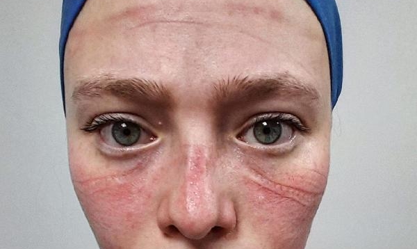 Sağlıkçıların Simgesi 'Seher Hemşire'nin Mutlu Günü