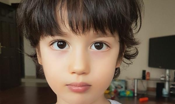 8 Yaşındaki Toprak, Covid-19 Sonrası Gelişen Miyofasiyal Ağrı Sendromundan Öldü