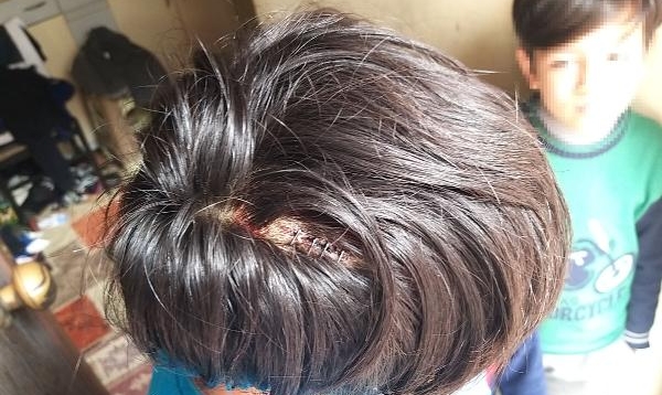 Cep Telefonu Kavgasında Abisinin Başını Yardı