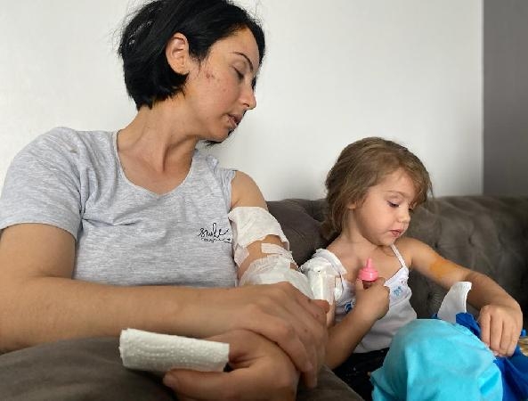 Restoran çıkışı köpek saldırısına uğrayan anne- kız yaralandı