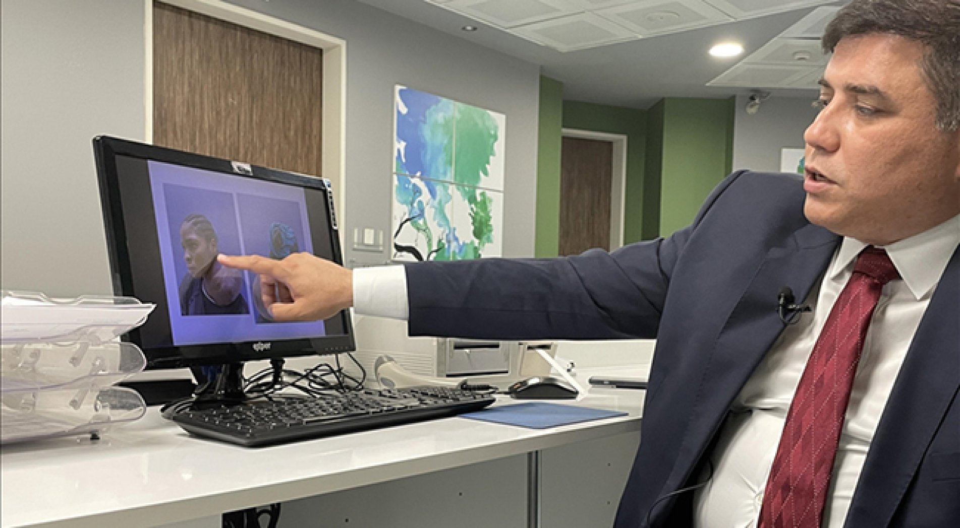 Boynundaki 3 kilogramlık tümörden Türkiye'deki ameliyatla kurtuldu