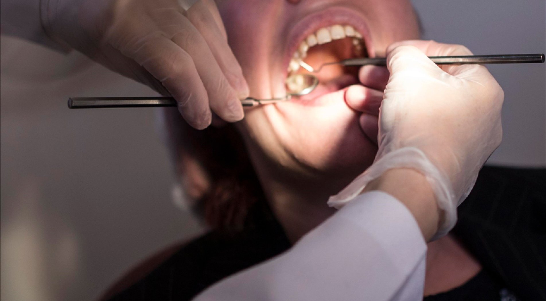 Devlet hastanelerinde engellilere özel diş tedavi merkezi açılacak