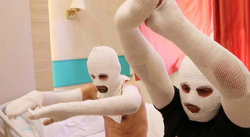 Otomobilde biri çakmağına gaz doldururken diğeri sigara yakmaya kalkan iki arkadaş hastanelik oldu