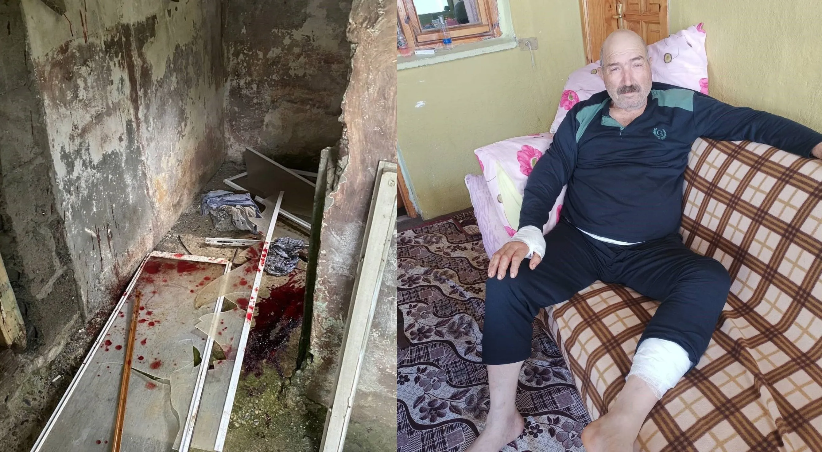 Artvin’de ayının saldırısına uğrayan şahıs yaşadığı o dehşet anlarını anlattı