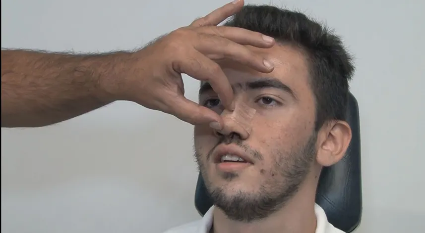 3 yaşında burnunda travma meydana geldi