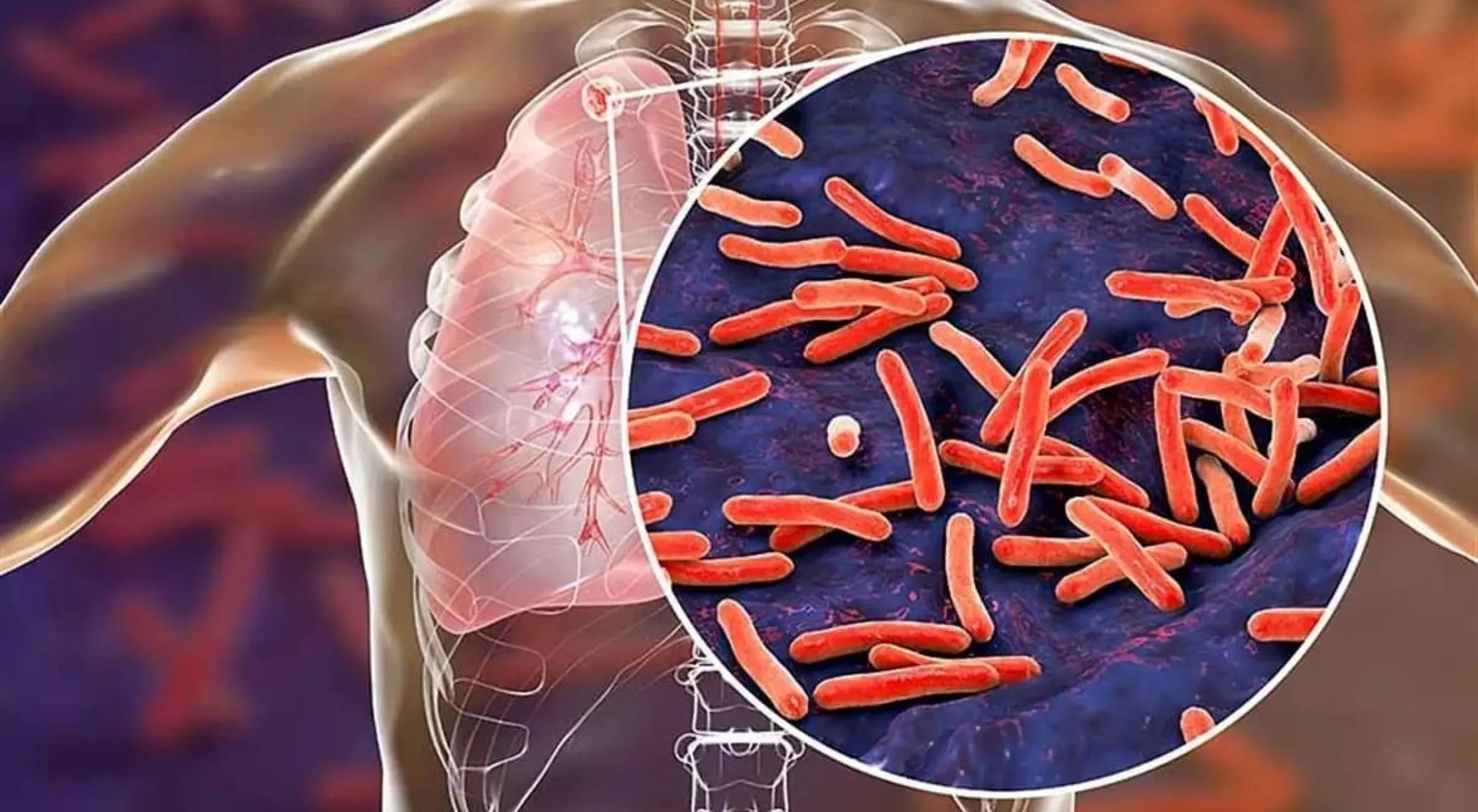 Dünyanın ikinci ölümcül hastalığı belli oldu