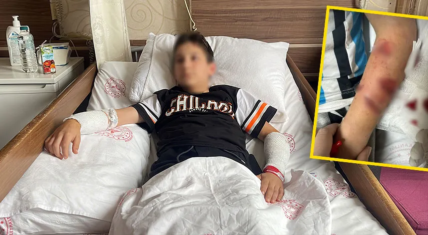 Köpeğin saldırısına uğrayan çocuk: Direkt kollarıma saldırdı