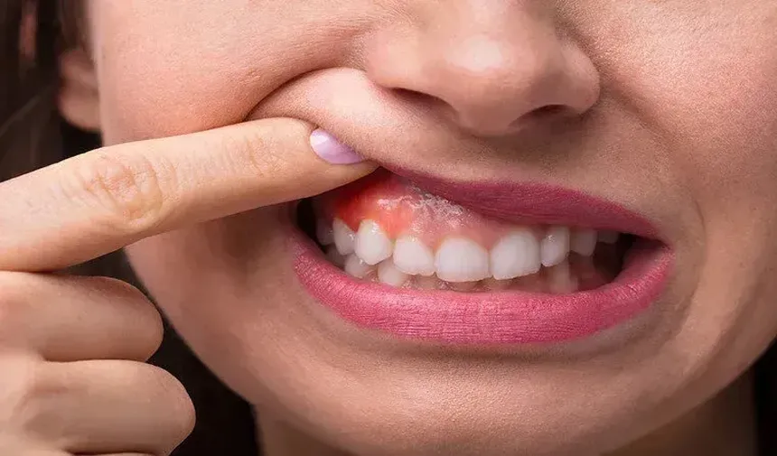 Biruni Üniversitesinden ağız kokusuna ilişkin değerlendirme