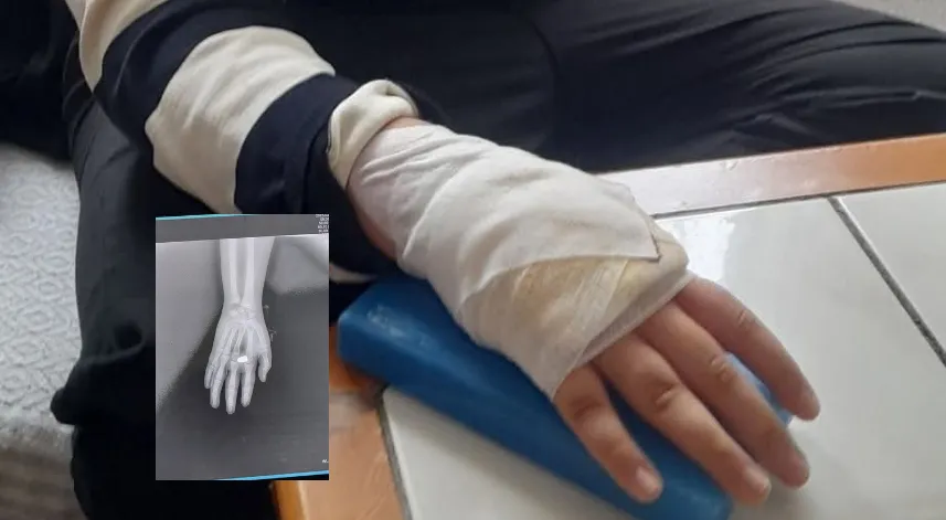 Eline yorgun mermi düşen çocuk yaralandı