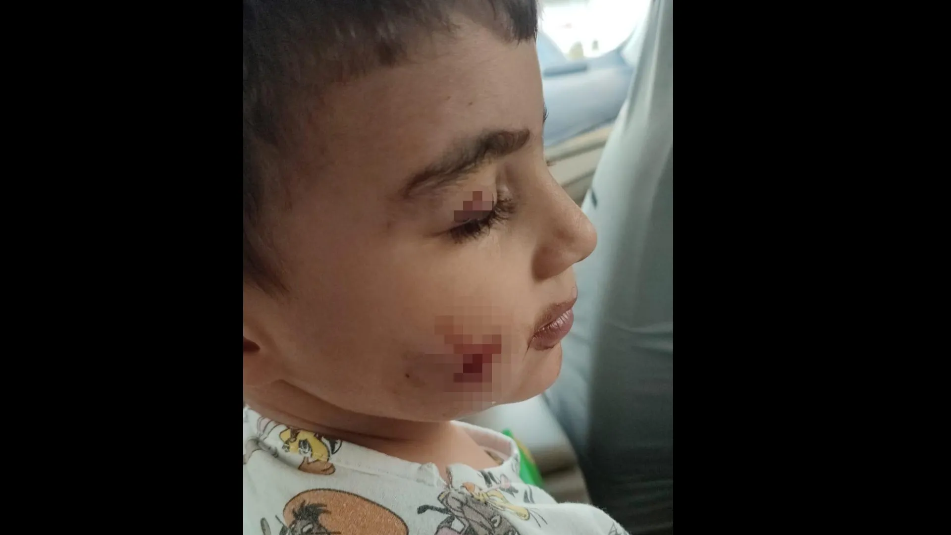 Evde uyuyan çocuğu lağım faresi ısırdı