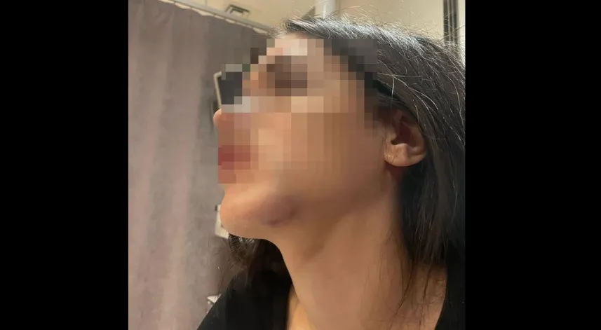 Eski sevgilisi tarafından darbedildiğini iddia edip, fotoğraflarını sosyal medyada paylaştı