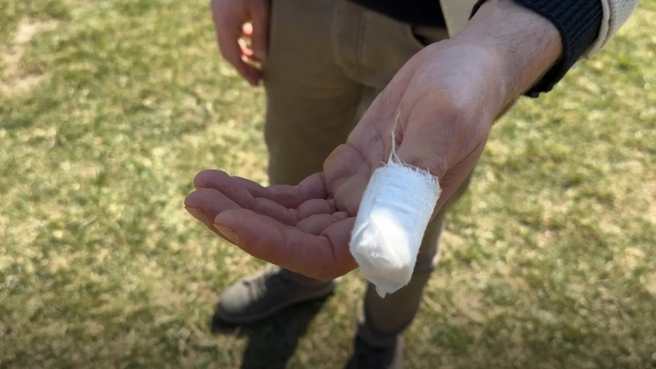 Parkta köpeği Şans ile gezerken başıboş pitbullun saldırısına uğradı